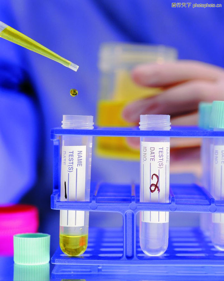 医学知识0023-医学知识图-医疗图库-黄色液体